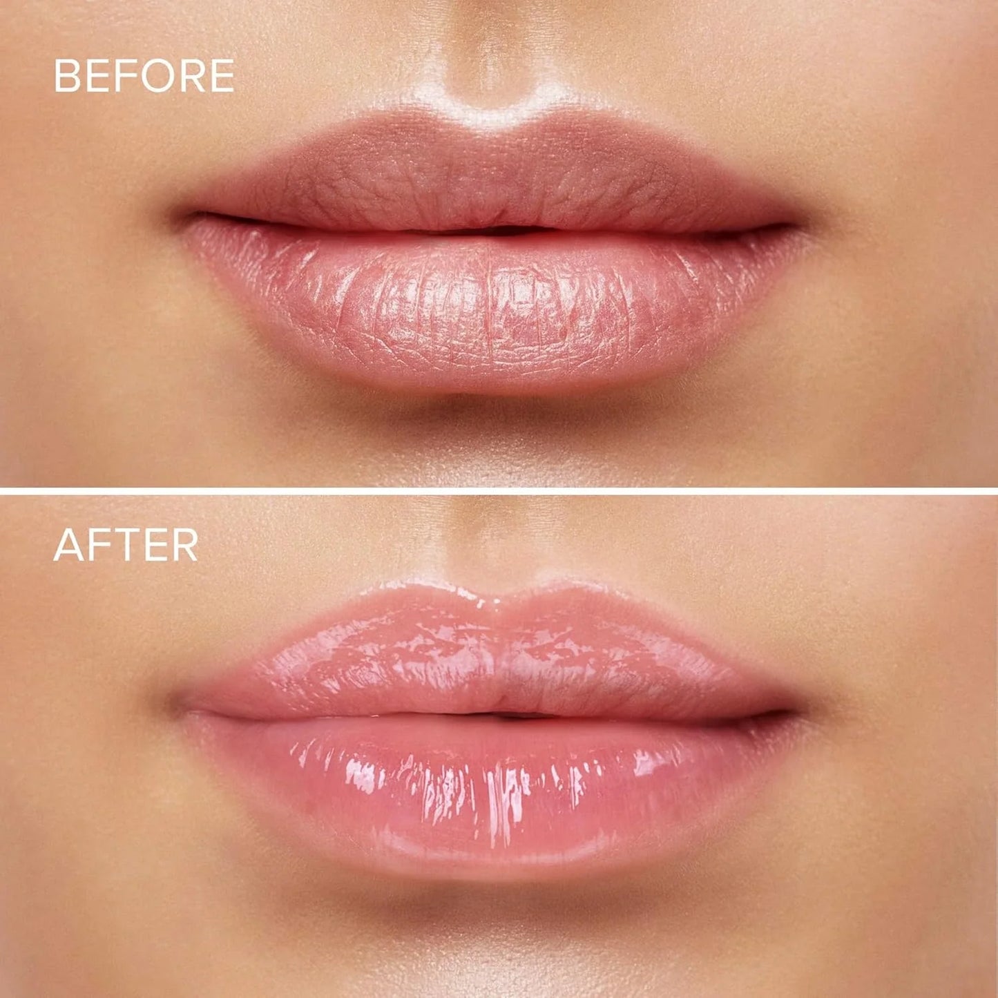 LipBoost® Combo Hidratante de labios + regalo especial