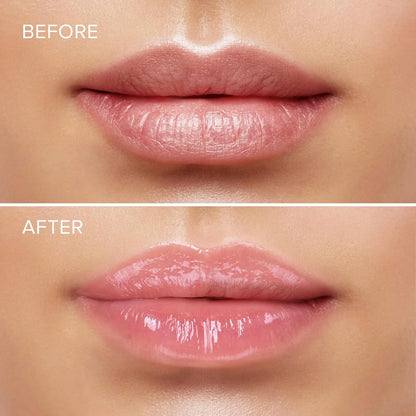 LipBoost® Combo Hidratante de labios + regalo especial