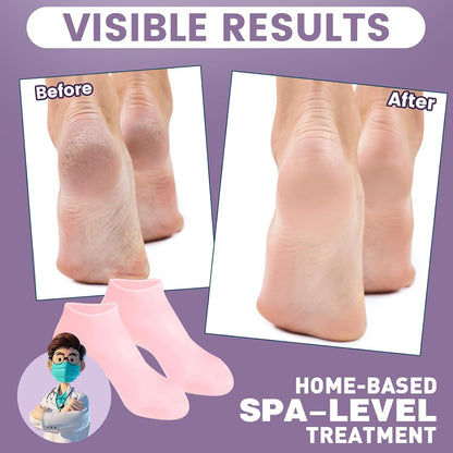 Confort™ Calcetines Hidratantes de Silicona x2